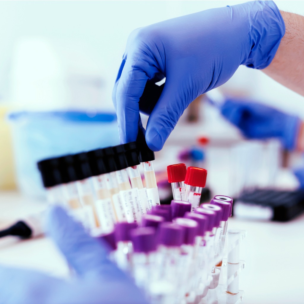 Drug Testing